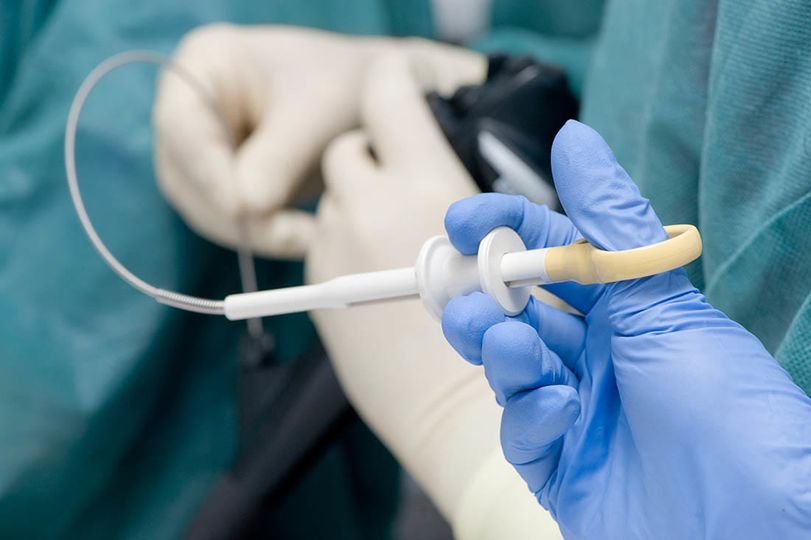 De Lellis di Rieti, eseguita endoscopia toracica con agobiopsie attraverso mini sonda ecografica