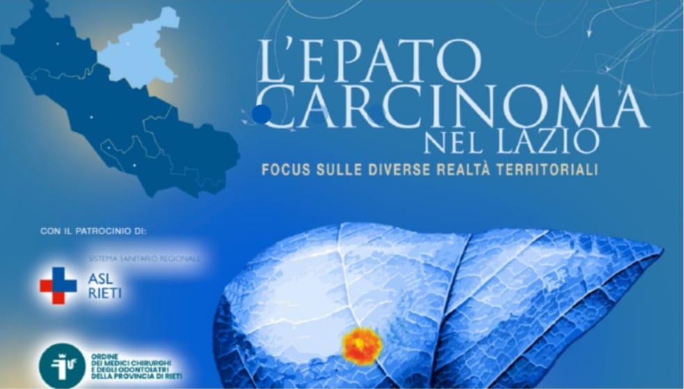 Rieti: giornata sull’epatocarcinoma, il 16 dicembre evento formativo a Villa Potenziani